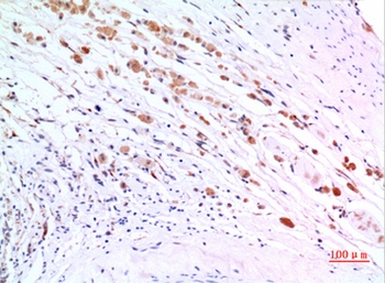 ZKSCAN4 rabbit pAb Antibody
