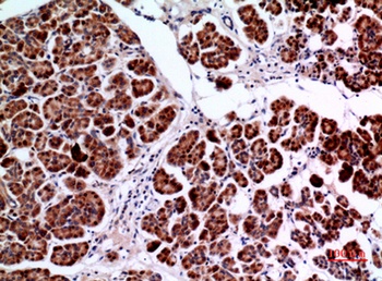 Amphiphysin II rabbit pAb