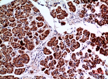 Amphiphysin II antibody