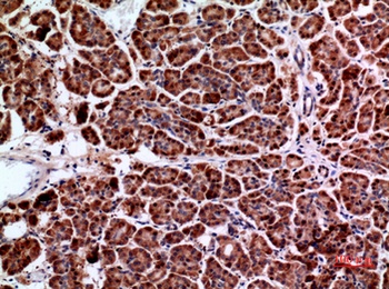 Amphiphysin II rabbit pAb