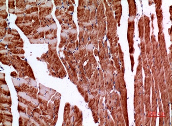 Amphiphysin II rabbit pAb