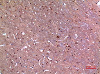 GDI-2 antibody