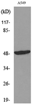 HNF-3 alpha/beta/gamma antibody