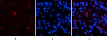 EPAS-1 antibody