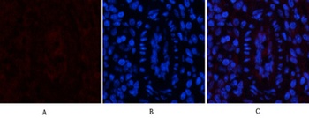 EPAS-1 antibody