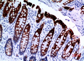 Cytokeratin 8 rabbit pAb