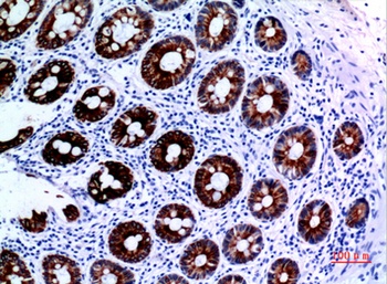 Cytokeratin 8 rabbit pAb