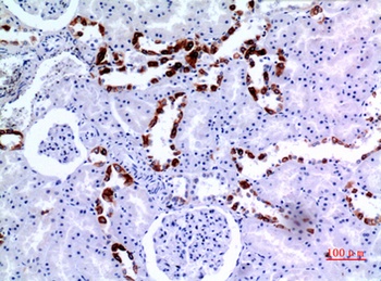 Cytokeratin 8 rabbit pAb