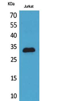 p57 rabbit pAb