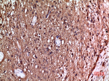 Tubulin alpha antibody