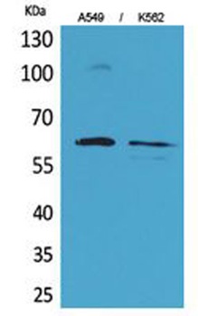 Smad1 rabbit pAb Antibody