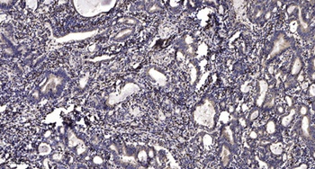 Smad1 rabbit pAb Antibody