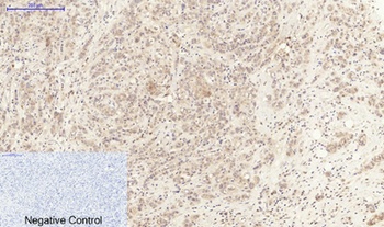 IL6 antibody