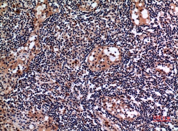 Cytokeratin 19 rabbit pAb