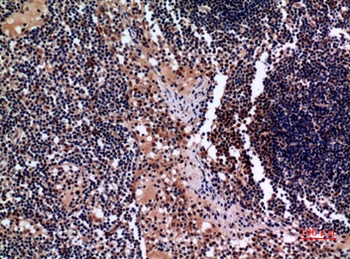 Cytokeratin 19 rabbit pAb