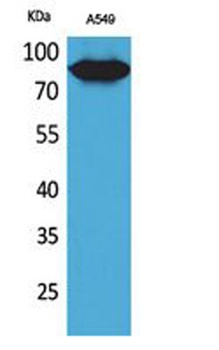 CD10 rabbit pAb Antibody