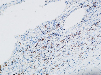 MPO_ Myeloperoxidase antibody