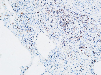 MPO_ Myeloperoxidase antibody