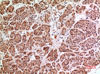 HPA1 antibody