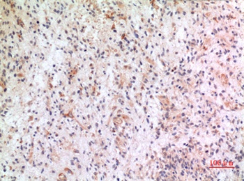 Fractalkine antibody