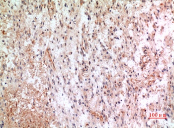 Fractalkine antibody