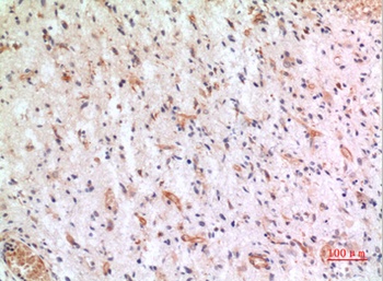 Fractalkine antibody