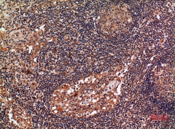 ALDH2 antibody