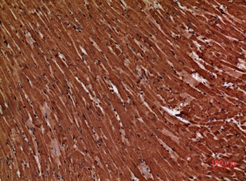 Troponin T-C antibody