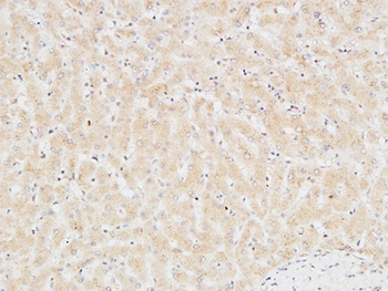 Troponin T-C rabbit pAb