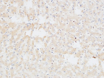 Troponin T-C antibody