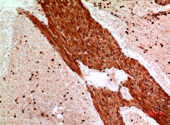 Angptl1 antibody