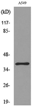 CGR19 antibody