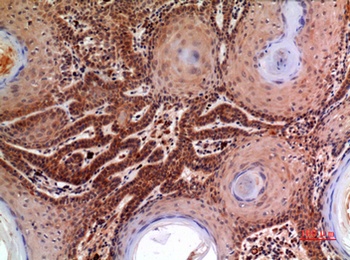 Macroglobulin alpha-2 antibody