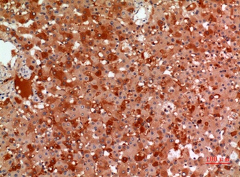 Macroglobulin α-2 rabbit pAb
