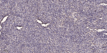 SCYL1BP1 antibody