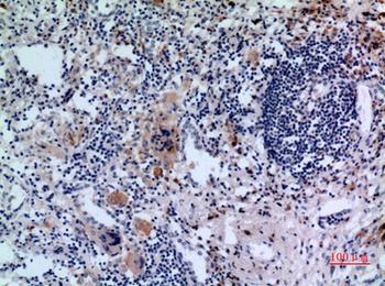 CD71 antibody