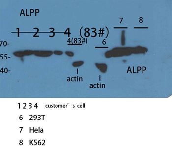 ALPP/ALPPL2 rabbit pAb