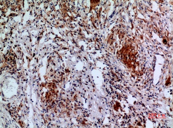 Apaf-1 antibody