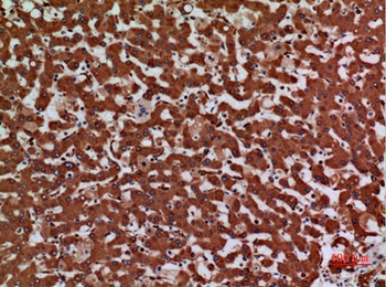 Laminin γ-2 rabbit pAb