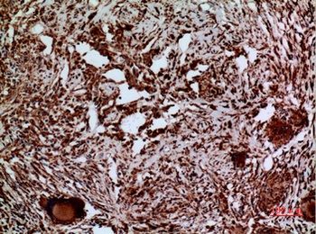 Laminin γ-2 rabbit pAb