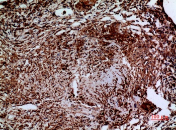 Laminin γ-2 rabbit pAb