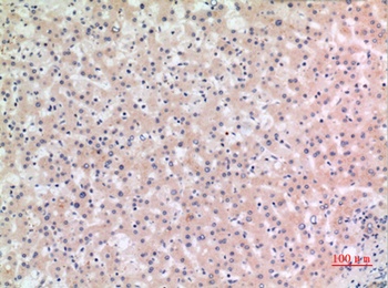 Cryopyrin rabbit pAb