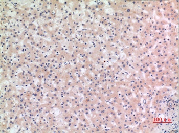 Cryopyrin antibody