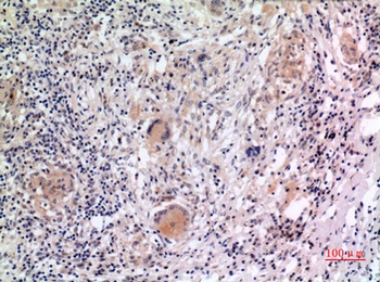 Cryopyrin antibody