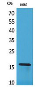 CRBP II antibody