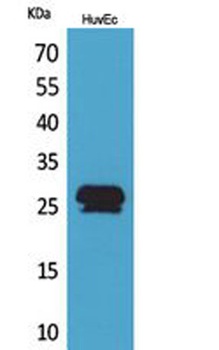 CacyBP antibody