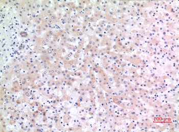 CD166 antibody