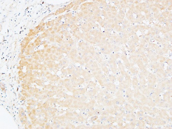 CD166 antibody