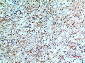 IL8R beta antibody