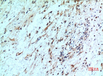 IL8R beta antibody